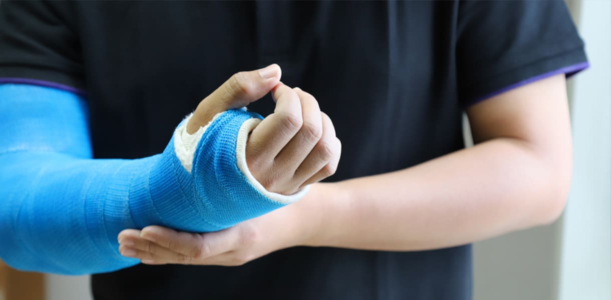 Colocación de fibra de vidrio circular