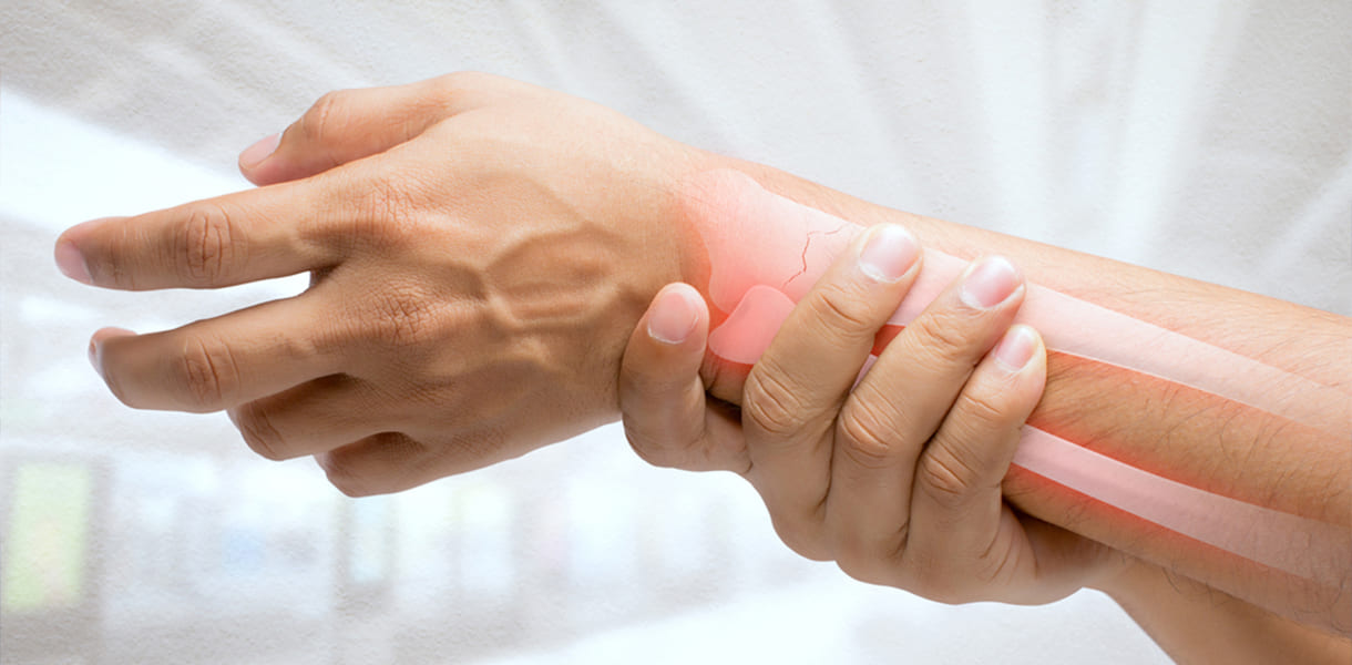 Reducción cerrada de luxaciones o fracturas